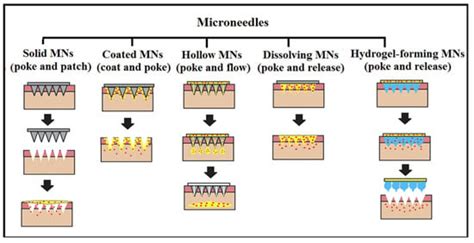 Hydrogel Forming Microneedles In The Management Of Dermal Disorders