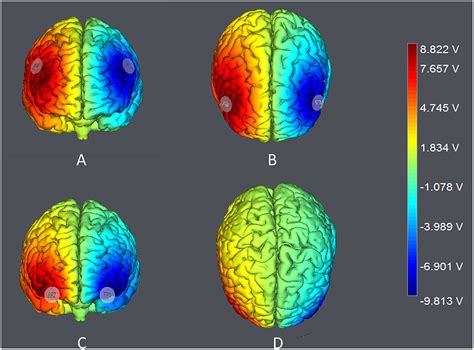 Frontiers Modulating The Activity Of The Dlpfc And Ofc Has Distinct