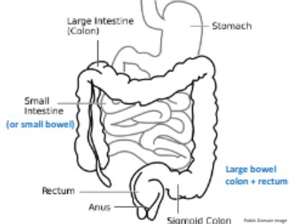 Chronic Bowel Disease Flashcards Quizlet