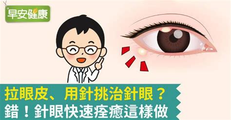 針眼該熱敷、冰敷好？針眼快速痊癒實用5招防復發 早安健康 Line Today