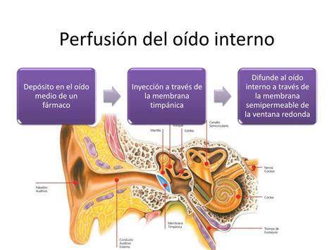 Ppt Hipoacusia SÚbita Sensorineural IdiopÁtica Powerpoint