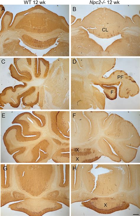 Cerebellar Purkinje Cell Degeneration In Weeks Old Npc Mice