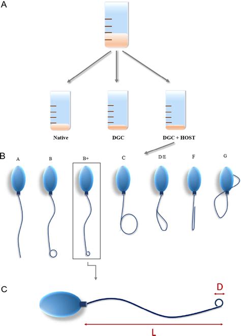 A The Sperm Sample Is Divided Into 3 Parts The First Part Native Was