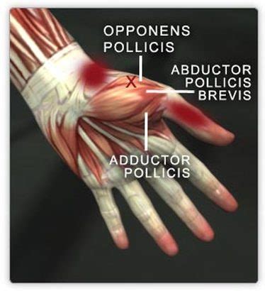 Abductor Pollicis Brevis Muscle - Anatomy of Hand / The csp was measured from the abductor ...