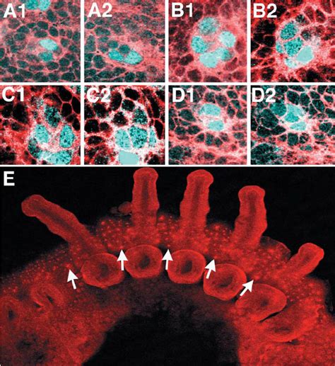 A1 D2 Snail Protein Expression In Serially Homologous Invagination Download Scientific