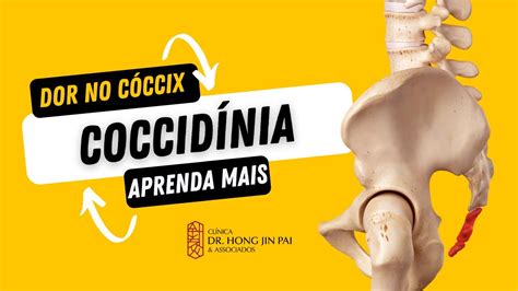 Dor No Cóccix Coccidínia Causas Sintomas E Tratamentos Youtube