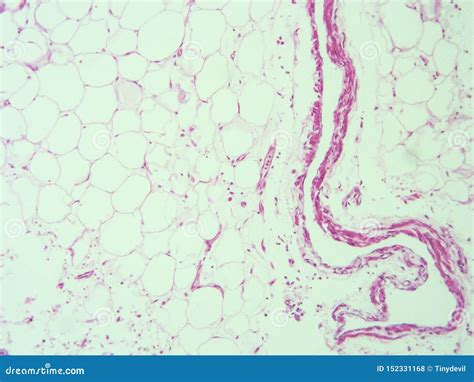 Histology Of Human Adipose Tissue Stock Photo | CartoonDealer.com ...