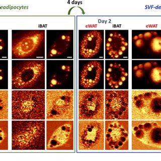 The Flow Scheme Showing The Isolation Of Primary Adipocytes And