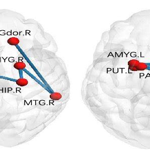 Ordinal Patterns Of Nc And Early Mild Cognitive Impairment Patients