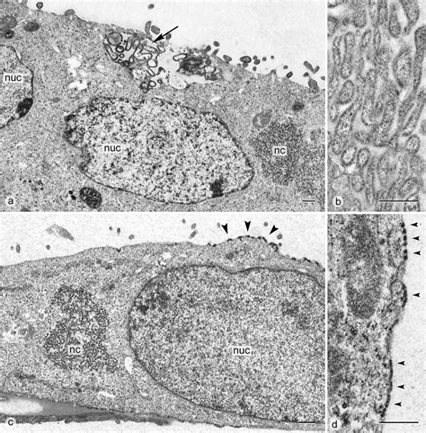 Ultrastructural Findings In Infected Vero Cells A Op Cdv 24 H P I Download Scientific Diagram