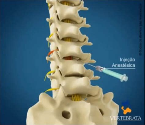 Clínica Da Coluna Vertebrata Medico De Coluna Porto Alegre