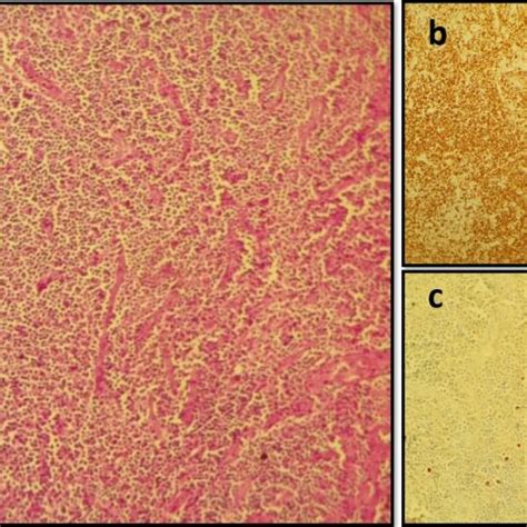 Lymph Node Histology A Microscopic Image After Staining With