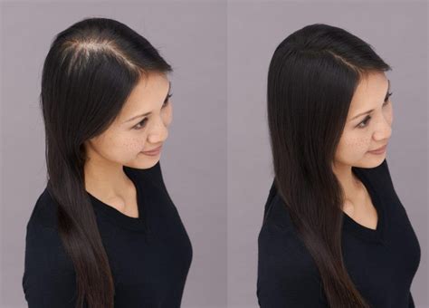 How To Know Your Hair Is Thin A Comprehensive Guide Best Simple