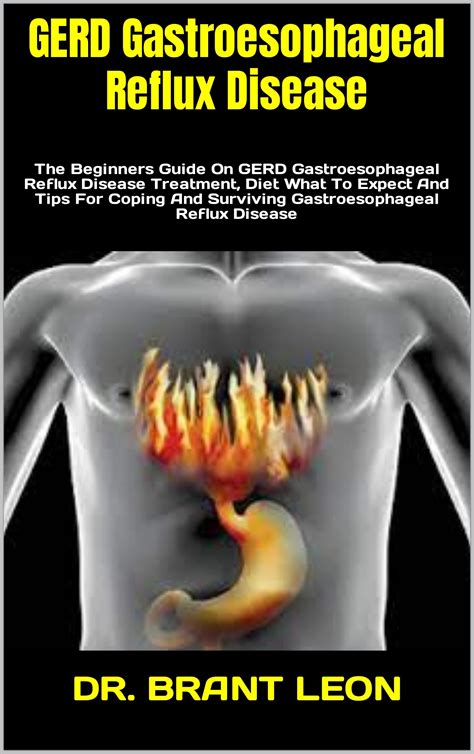 Buy Gerd Gastroesophageal Reflux Disease The Beginners Guide On Gerd