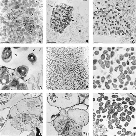 Differentiation Of Zone V In Alfalfa Nodules Bright Field Microscopy Download Scientific