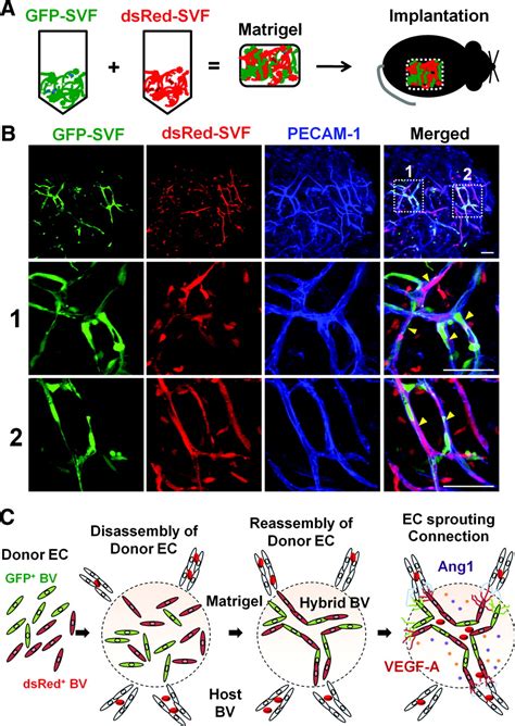 Stromal Vascular Fraction From Adipose Tissue Forms Profound Vascular