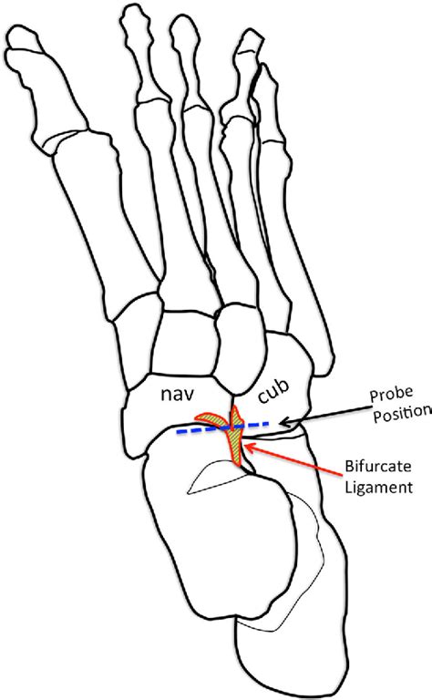 Structure Of Bifurcated Ligament Semantic Scholar