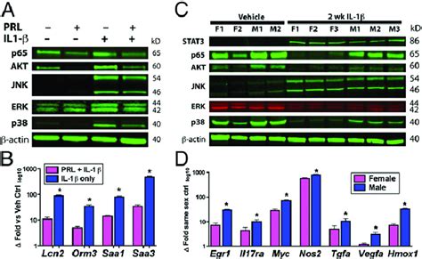 Prolactin Female Sex Constrains Hepatocellular Il 1β Responses In Vitro