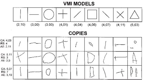 Visual Motor Integration Deficits In Q Deletion Syndrome Off