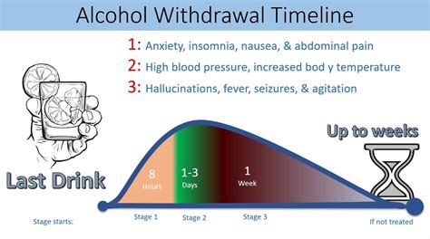 Alcohol Withdrawal Symptoms Timeline