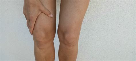 Artrosis De Rodilla Aprende Como Puedes Caminar Sin Dolor