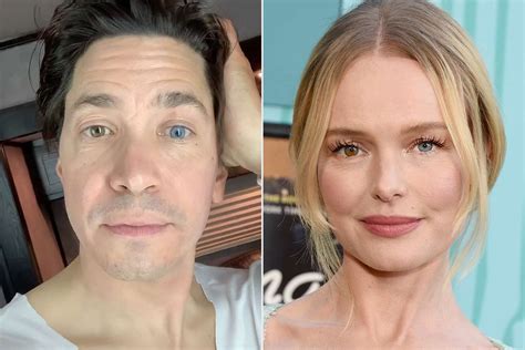 Justin Long Pokes Fun At Kate Bosworth S Different Eye Colors