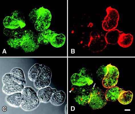 Characterization Of Entamoeba Histolytica Intermediate Subunit Lectin Specific Human Monoclonal