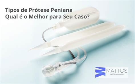 Tipos de Prótese Peniana Qual é o Melhor para Seu Caso