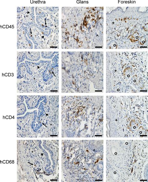 Human Hematopoietic Cells Relevant To Hiv Infection Efficiently