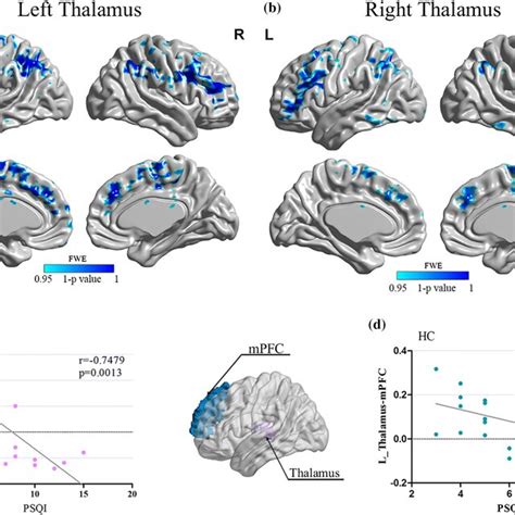 A B The Resting‐state Functional Connectivity Rsfc Of Thalamic