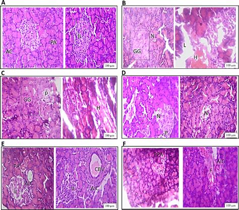 Histopathological Changes In The Pancreas Of Diabetic Rats Administered