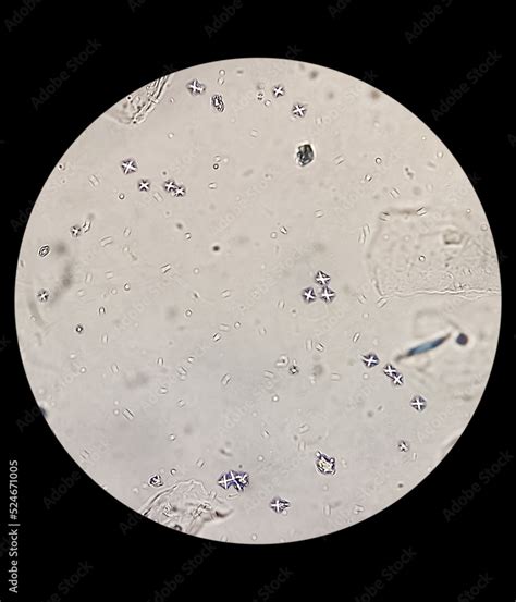 Trichomonas In Urine Sediment