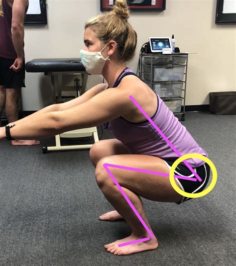 Hip Pain: A Pain in the Butt – Power House Physio