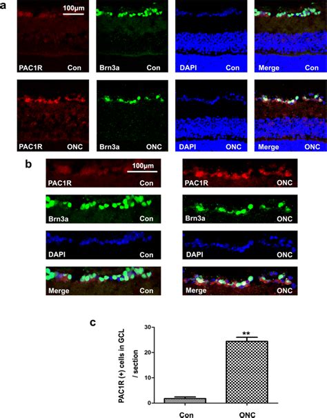 Retinal Ganglion Cells Express Pac R Confocal Images Showing