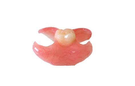 Maxillary Partial Denture Cast Metal