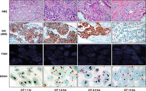 Representative Hande Immunohistochemistry Fluorescence In Situ