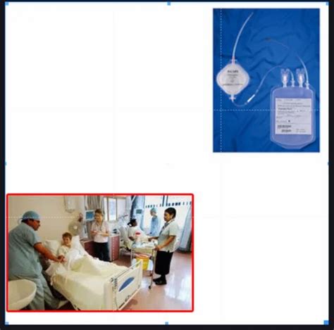 Gen World Medical Devices Blood Filter For Hospital At Best Price In Mumbai