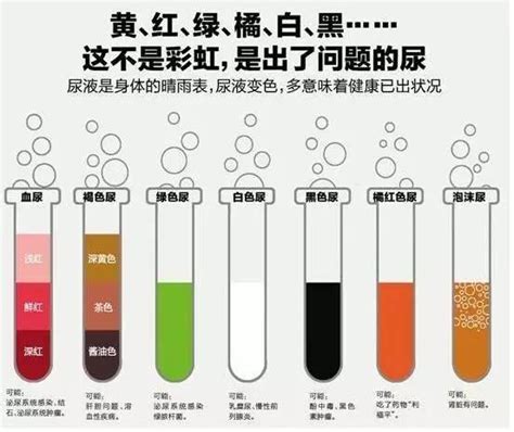 尿液与肾脏是一种什么样的关系呢 知乎