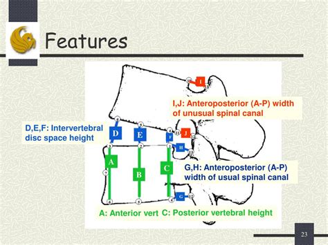 Ppt Computer Aided Diagnosis System For Lumbar Spinal Stenosis Using X Ray Images Powerpoint