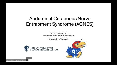 Abdominal Cutaneous Nerve Entrapment Syndrome Wdr David Embers