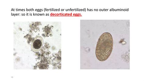 Ascaris Lumbricoides Ppt