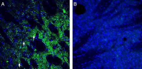 Anti ZIP14 SLC39A14 Antibody AZT 024 Alomone Labs