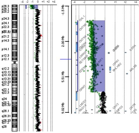 CGH - Bioarray