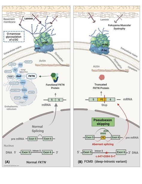 Novel Method With Implications For Treatment Of Fukuyama Muscular