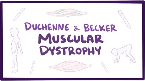 Muscular dystrophy: Video, Anatomy & Definition | Osmosis