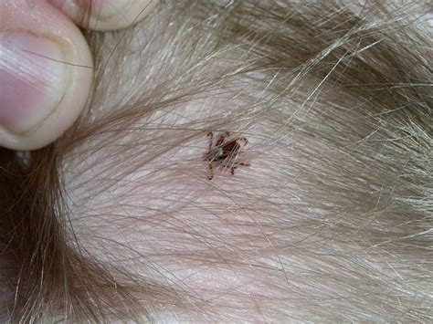 5 Facts Homeowners Dont Know About Deer Ticks