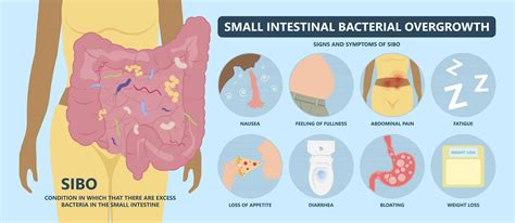 Key Signs Of Sibo Could A Diagnosis End Your Struggle