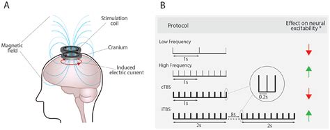 Intrinsic Plasticity Mechanisms Of Repetitive Transcranial Magnetic