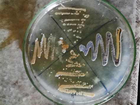 Actinomicetos Aplicaciones biotecnológicas