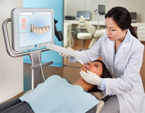 How Does Itero Scanner Work And Know More Option For Braces